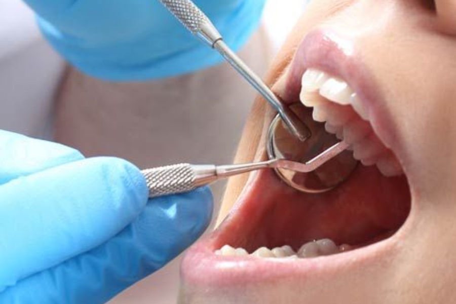 saatnya lindungi gigi kamu bersama odonto dental care