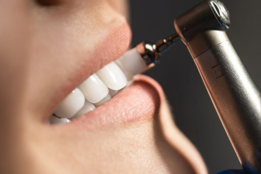 scaling dan kontrol rutin