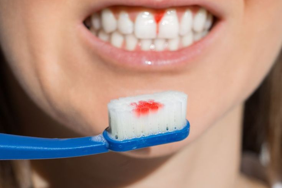 teknik menyikat gigi salah