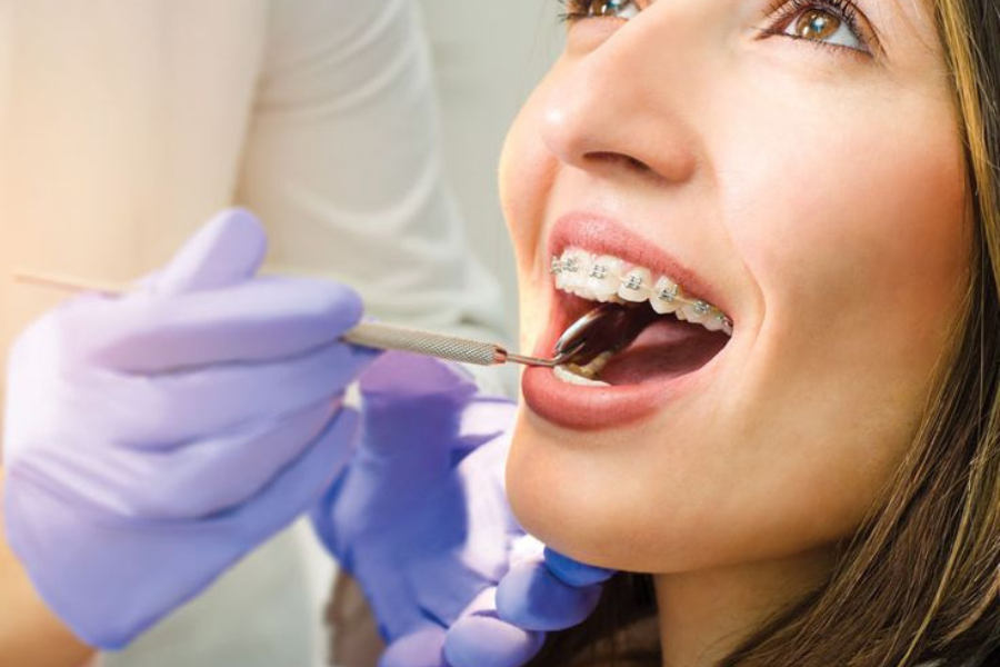 biaya pasang behel surabaya