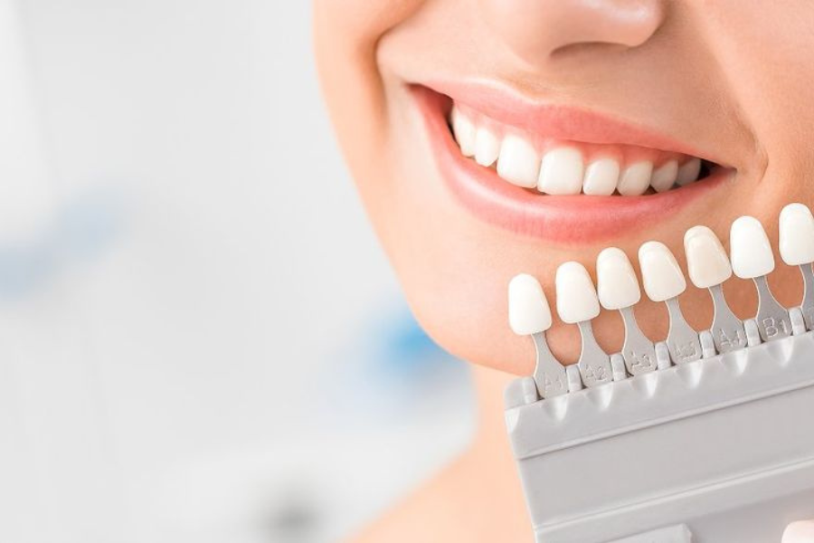 bleaching gigi surabaya