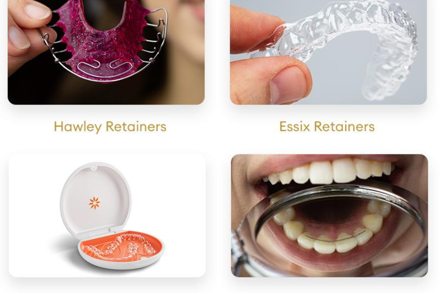 retainer gigi surabaya