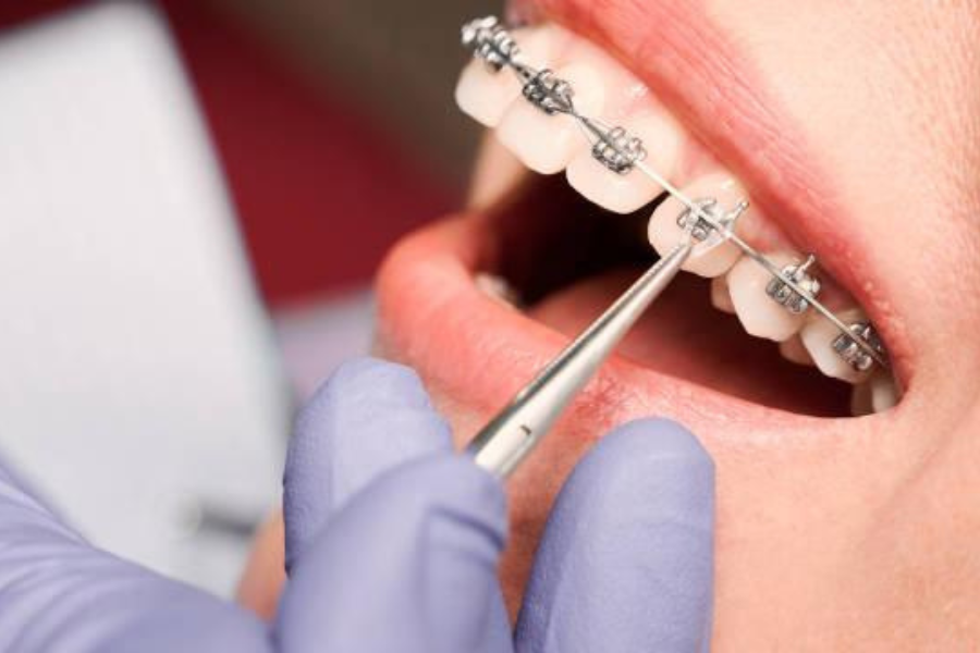 faktor yang memengaruhi biaya perawatan di odonto dental care