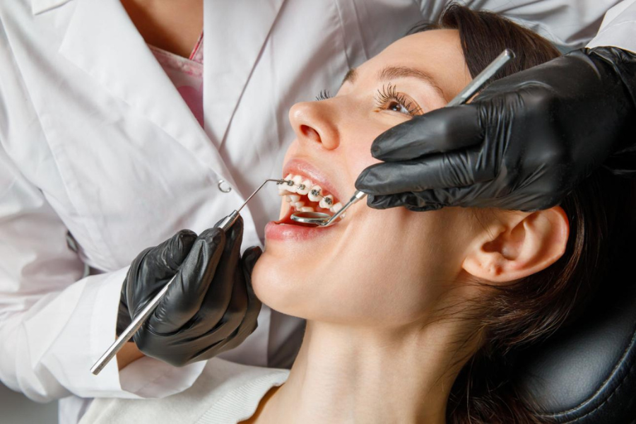 perbedaan behel damon dan behel conventional