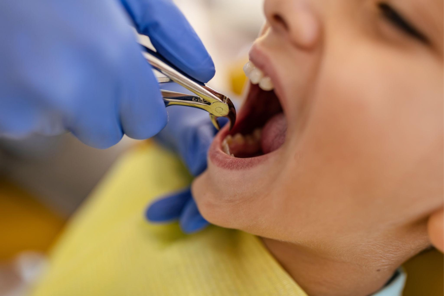 segera jadwalkan konsultasi di odonto dental care