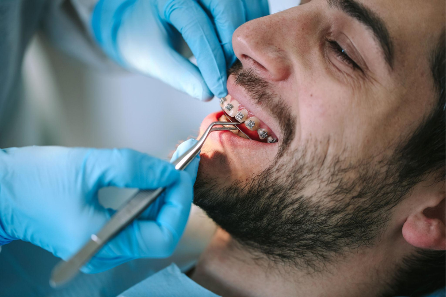 wujudkan senyum ideal bersama perawatan odonto dental care