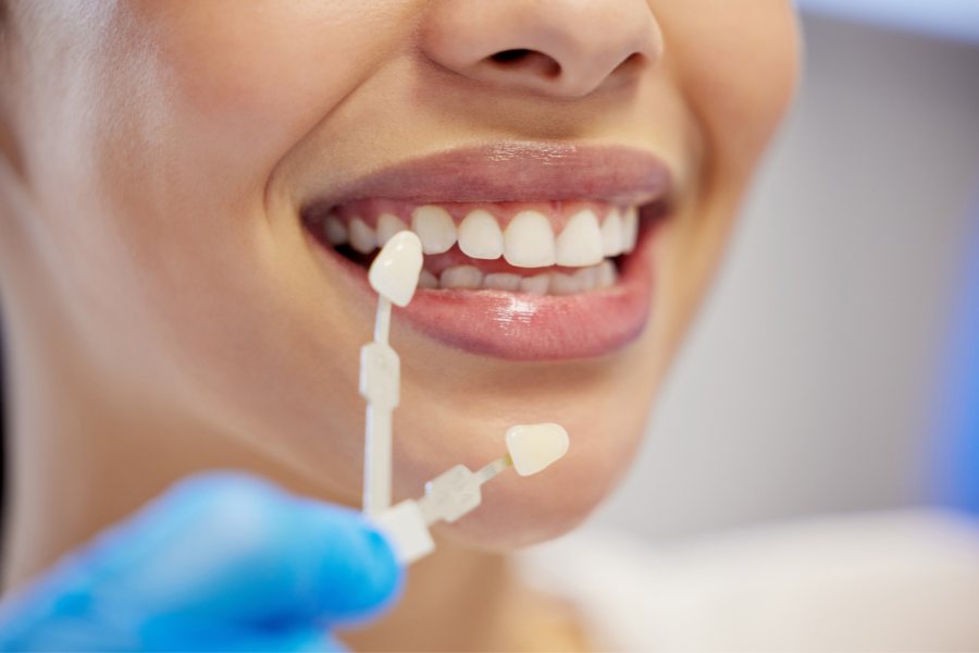 menghilangkan noda hitam gigi di odonto dental care
